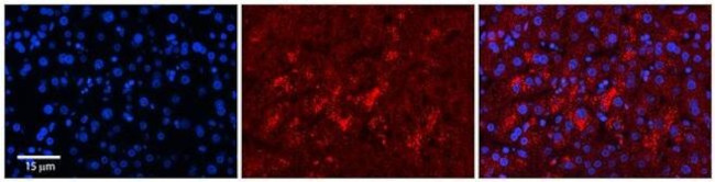 LYPLA2 Antibody in Immunohistochemistry (Paraffin) (IHC (P))