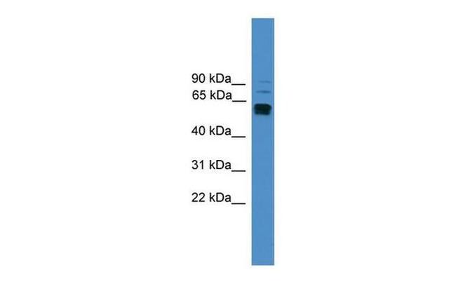 CD223 Antibody in Western Blot (WB)