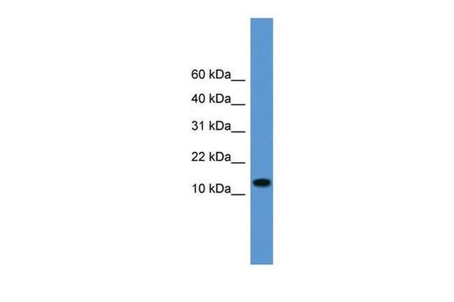 Substance P Antibody in Western Blot (WB)