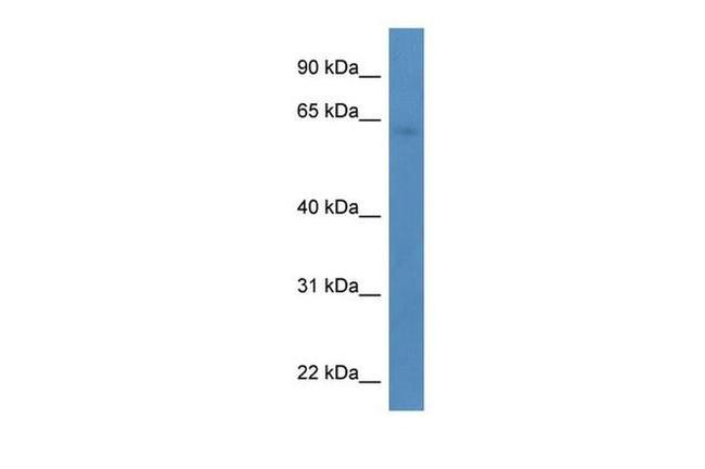 TBC1D10A Antibody in Western Blot (WB)