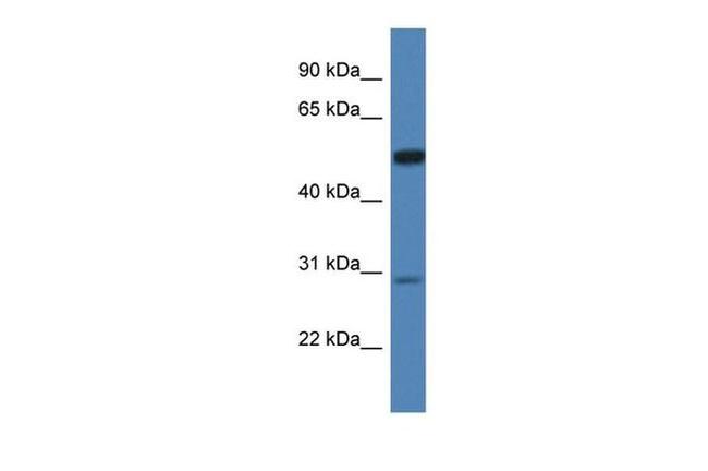 Iduronate 2 Sulfatase Antibody in Western Blot (WB)