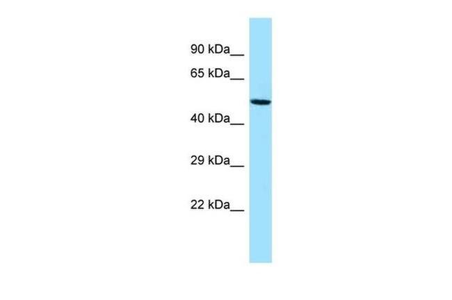 GPATCH4 Antibody in Western Blot (WB)