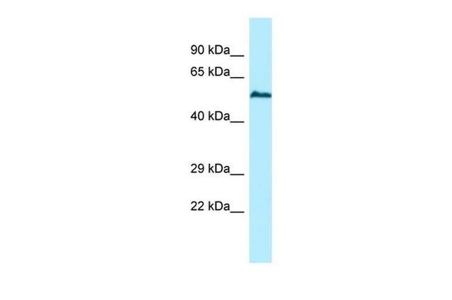 USP17L5 Antibody in Western Blot (WB)