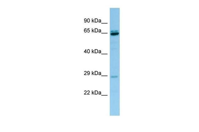 PRB3 Antibody in Western Blot (WB)