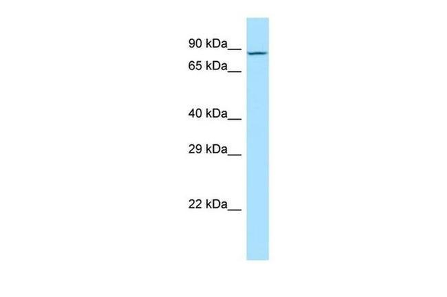 MDGA2 Antibody in Western Blot (WB)