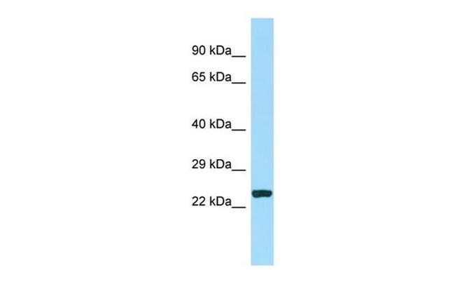 CDCA7 Antibody in Western Blot (WB)