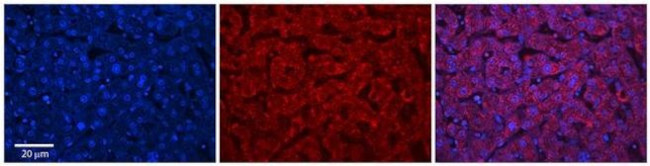 ABHD14A Antibody in Immunohistochemistry (Paraffin) (IHC (P))