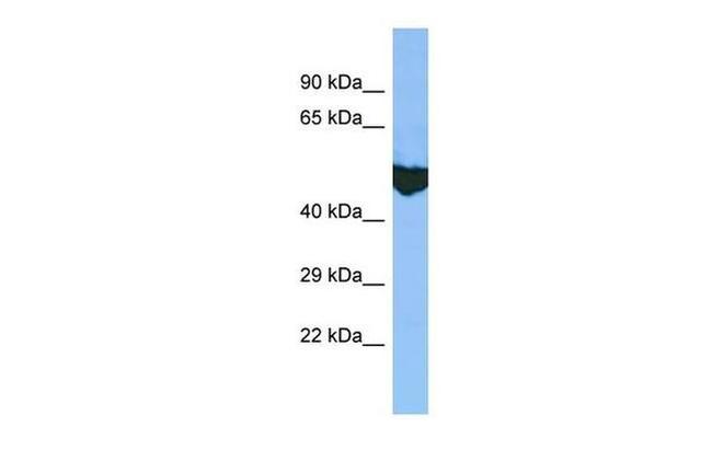 EXD2 Antibody in Western Blot (WB)