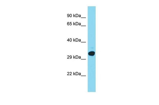 C15orf23 Antibody in Western Blot (WB)