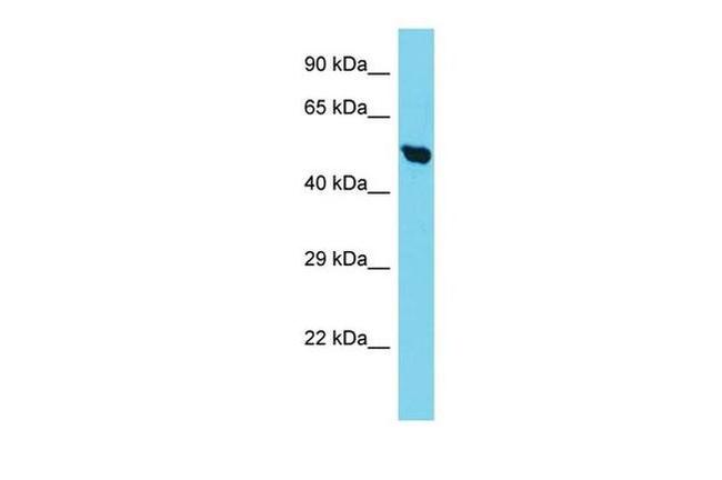 TIMM50 Antibody in Western Blot (WB)