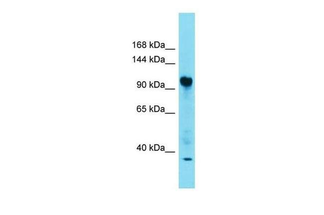 FAM91A1 Antibody in Western Blot (WB)