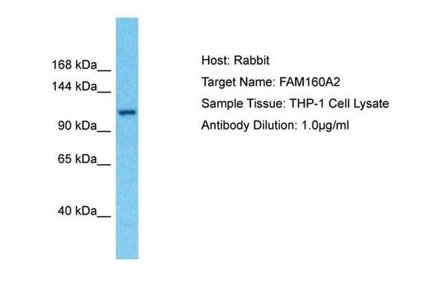 FAM160A2 Antibody in Western Blot (WB)