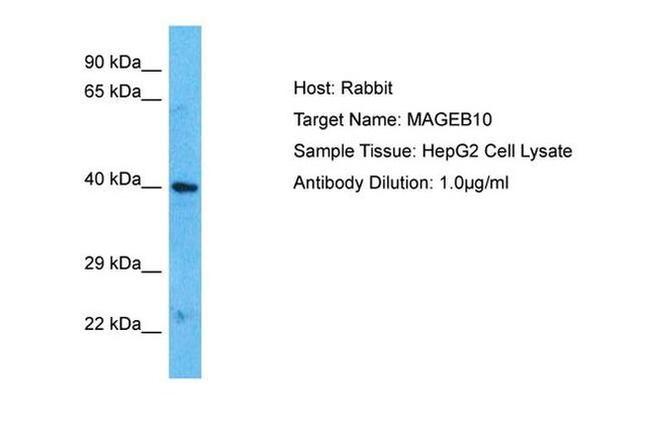 MAGEB10 Antibody in Western Blot (WB)