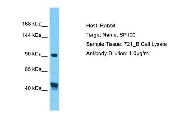 SP100 Antibody in Western Blot (WB)