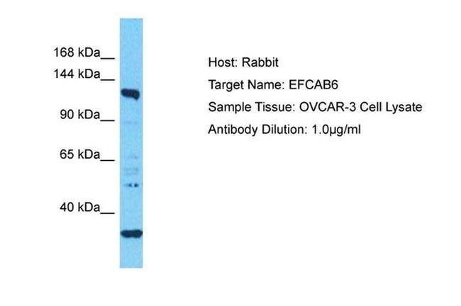 EFCAB6 Antibody in Western Blot (WB)