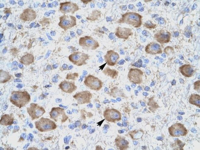 CD357 (AITR/GITR) Antibody in Immunohistochemistry (IHC)