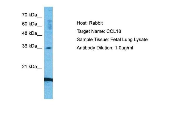 MIP-4 Antibody in Western Blot (WB)