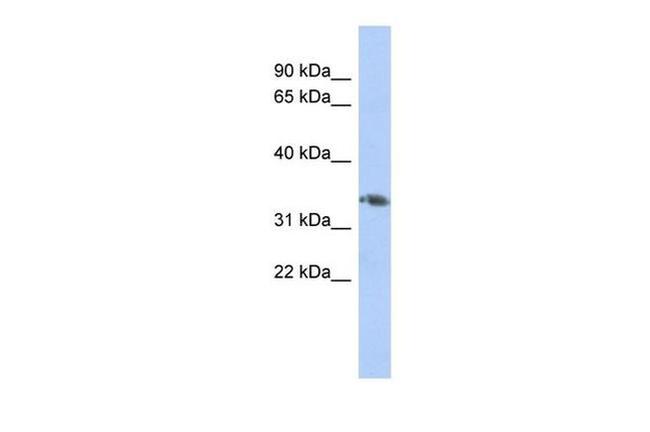 HOXD10 Antibody in Western Blot (WB)