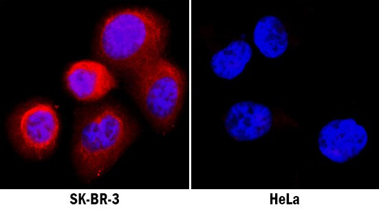 Activin A Antibody in Immunocytochemistry (ICC/IF)