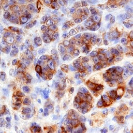 PLXND1 Antibody in Immunohistochemistry (Paraffin) (IHC (P))