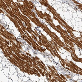 LPL Antibody in Immunohistochemistry (Paraffin) (IHC (P))