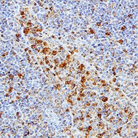 cIAP1 Antibody in Immunohistochemistry (Paraffin) (IHC (P))