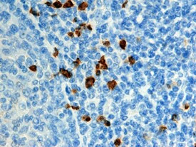 S100A12 Antibody in Immunohistochemistry (Paraffin) (IHC (P))