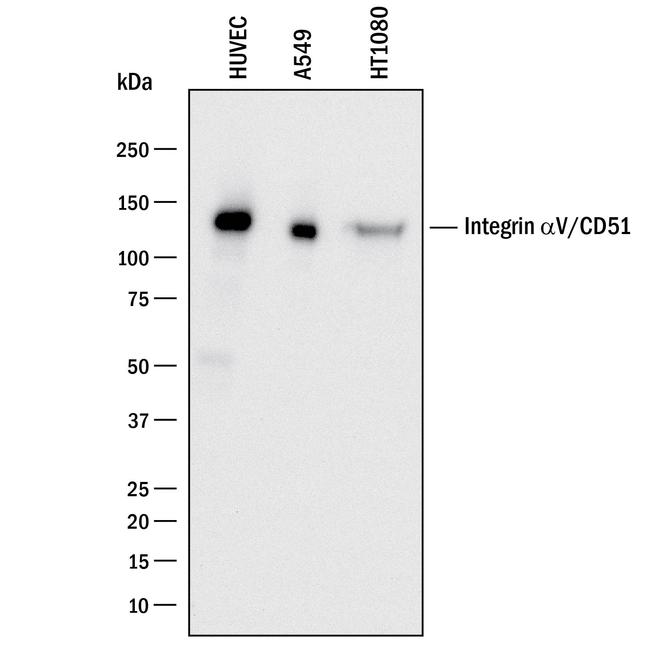 CD51 Antibody in Western Blot (WB)