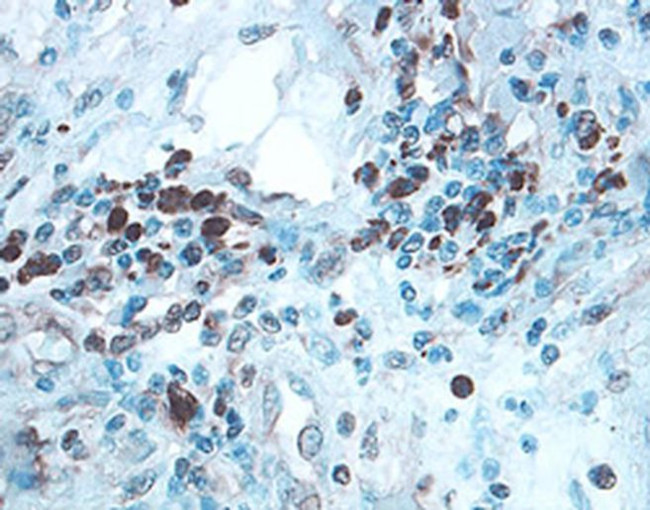 ULBP2/ULBP5/ULBP6 Antibody in Immunohistochemistry (Paraffin) (IHC (P))