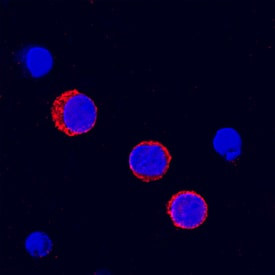 FCGR2B Antibody in Immunocytochemistry (ICC/IF)
