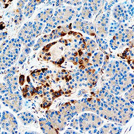 IGFBP7 Antibody in Immunohistochemistry (Paraffin) (IHC (P))