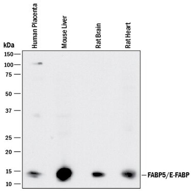 FABP5 Antibody in Western Blot (WB)