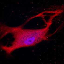 Jagged2 Antibody in Immunocytochemistry (ICC/IF)