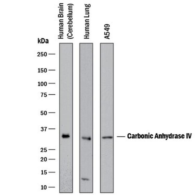 Carbonic Anhydrase IV Antibody in Western Blot (WB)