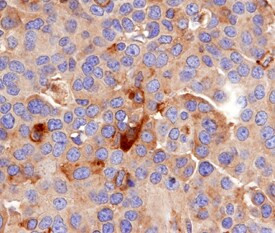 CLEC5A Antibody in Immunohistochemistry (Paraffin) (IHC (P))