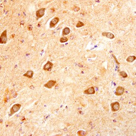 LIF Antibody in Immunohistochemistry (Paraffin) (IHC (P))