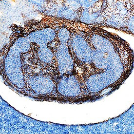 TGFBI Antibody in Immunohistochemistry (Frozen) (IHC (F))