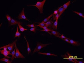 K-cadherin Antibody in Immunocytochemistry (ICC/IF)