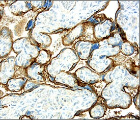 CD200 Antibody in Immunohistochemistry (Paraffin) (IHC (P))