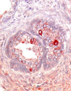 ACVR2A Antibody in Immunohistochemistry (Paraffin) (IHC (P))