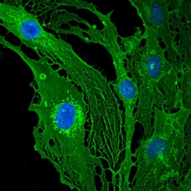 Thrombomodulin Antibody in Immunocytochemistry (ICC/IF)