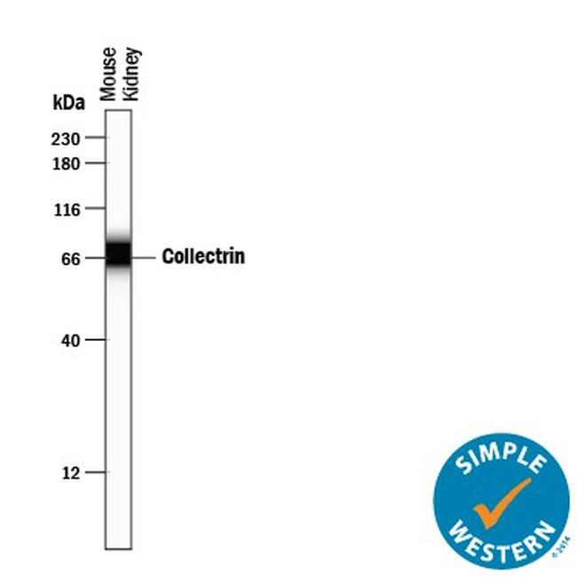 TMEM27 Antibody in Western Blot (WB)