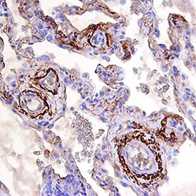 BMP-6 Antibody in Immunohistochemistry (Paraffin) (IHC (P))