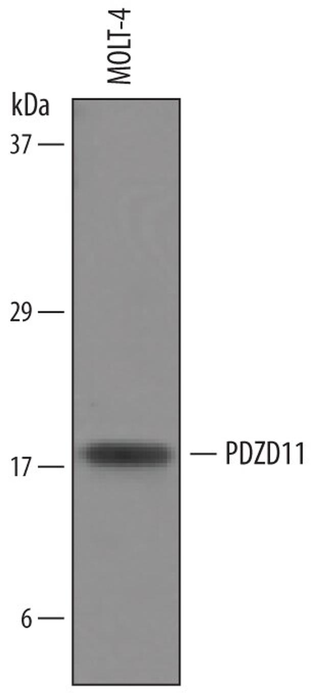 PDZD11 Antibody in Western Blot (WB)