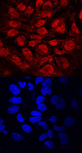 DPPA2 Antibody in Immunocytochemistry (ICC/IF)