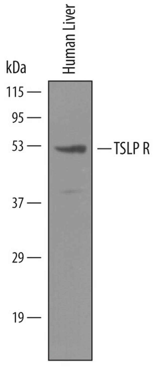 TSLP Receptor Polyclonal Antibody (PA5-47979)