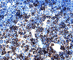 CD62L Antibody in Immunohistochemistry (Frozen) (IHC (F))