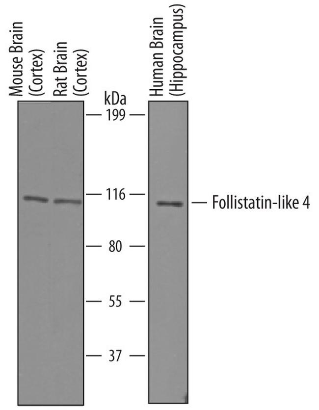 FSTL4 Antibody in Western Blot (WB)