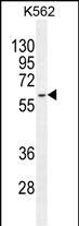 KRT73 Antibody in Western Blot (WB)