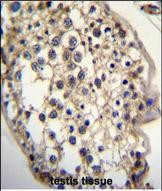 DHCR7 Antibody in Immunohistochemistry (Paraffin) (IHC (P))